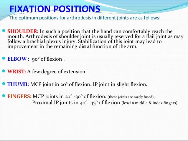 position of thumb ip fusion Position of thumb ip fusion